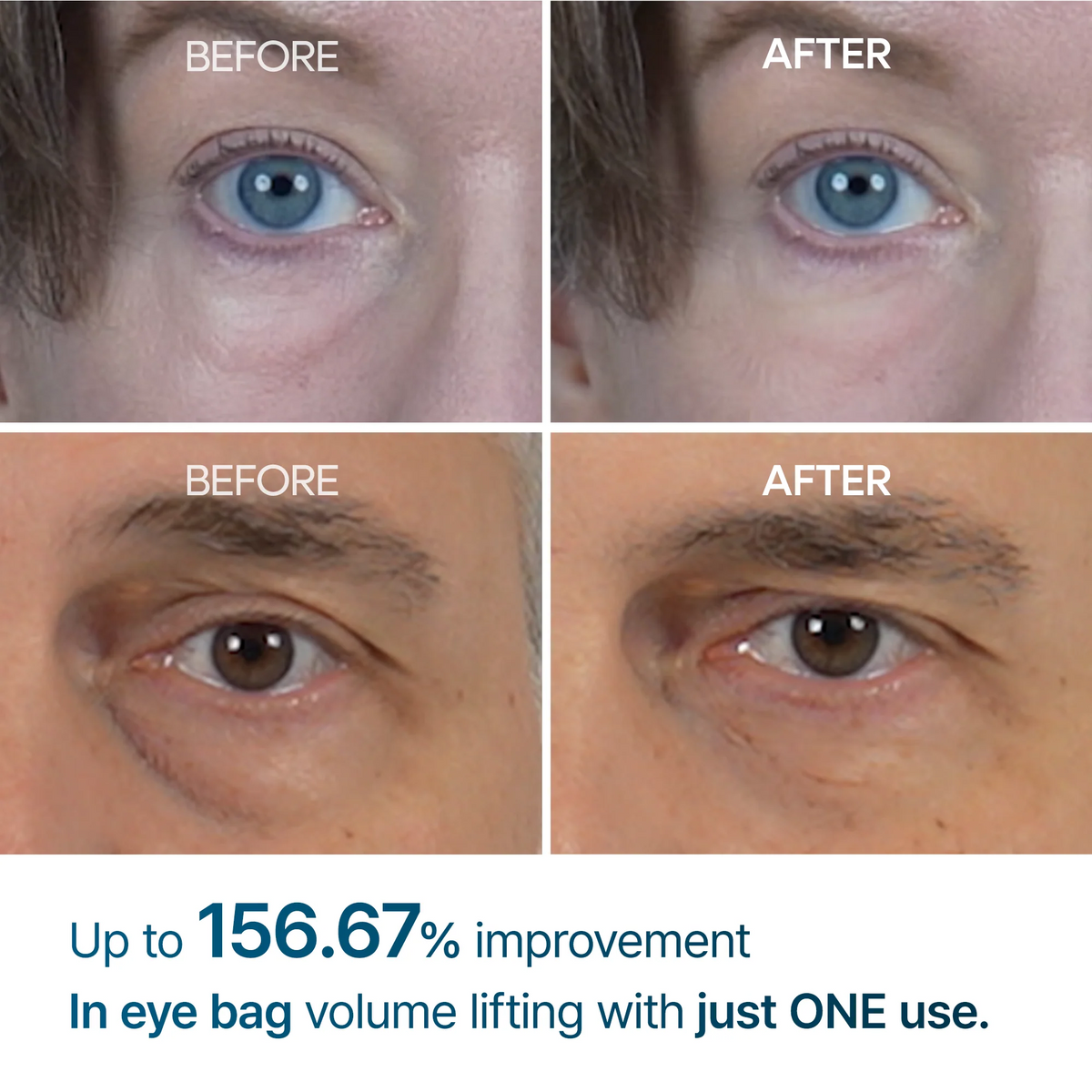 Eyephalt Eyebag Cream - 10g